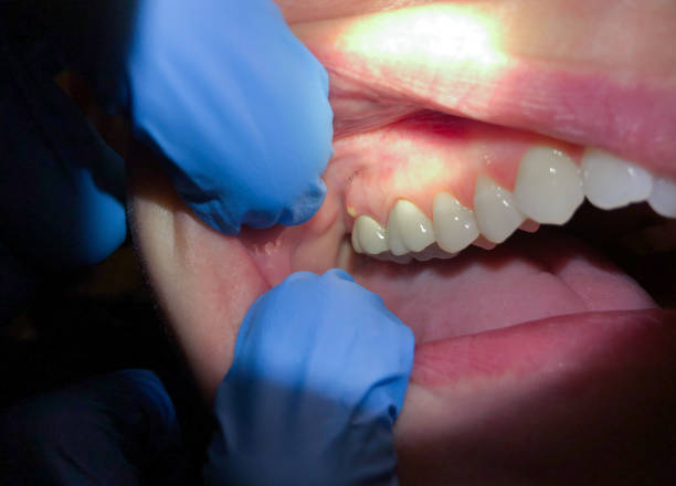 Best Emergency Treatment for Jaw Pain or Injury in Avon Lake, OH